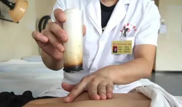產后艾灸一個月，十年少生?。?