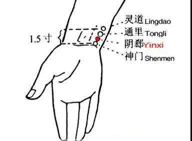 睡覺愛出汗，艾灸這幾個(gè)穴位